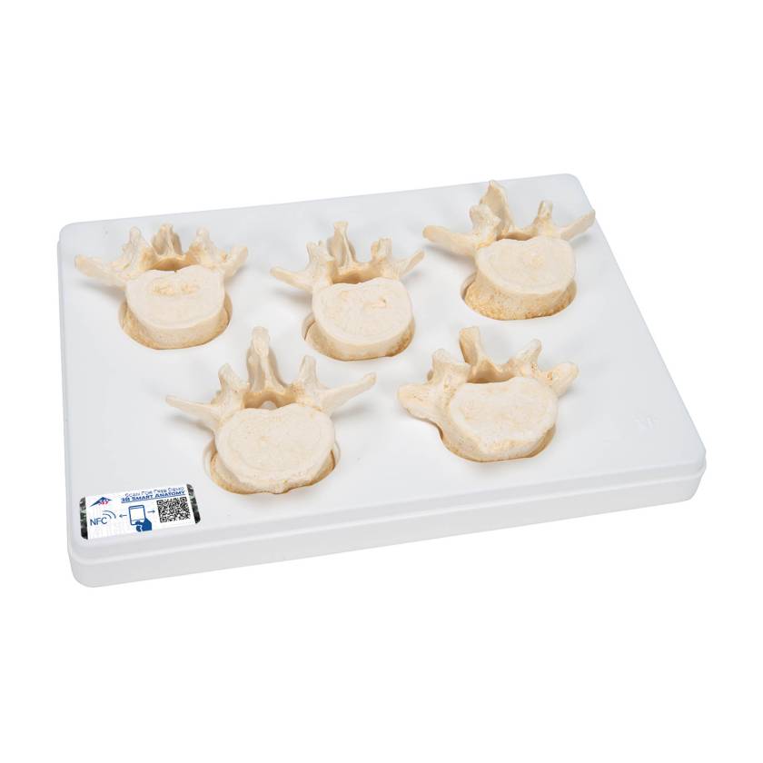 3B Scientific A792 Set of 5 BONElike Lumbar Vertebrae - 3B Smart Anatomy