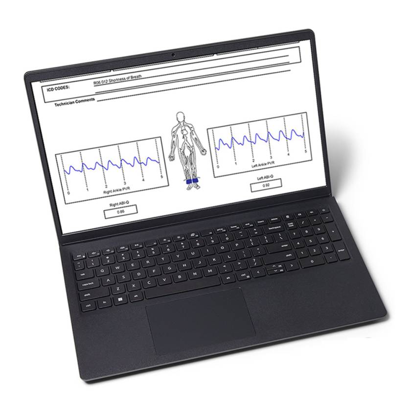 Newman Medical ABI-120 Newman Medical Windows Computer for simpleABI System