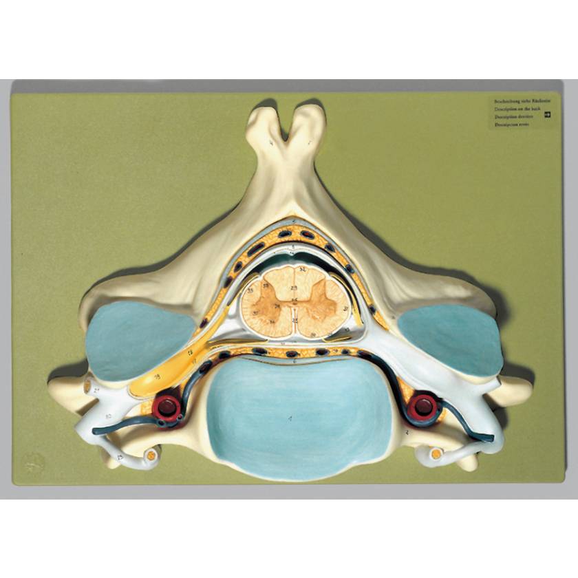 Fifth Cervical Vertebra