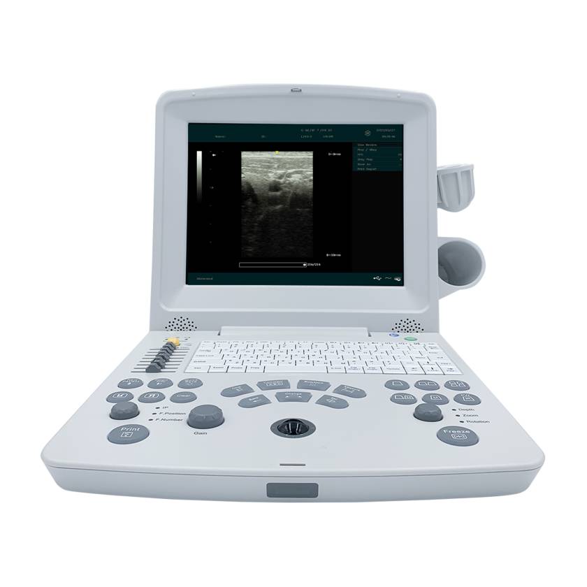 Edan DUS60-MAINUNIT DUS60 Black-and-White Compact Ultrasound System