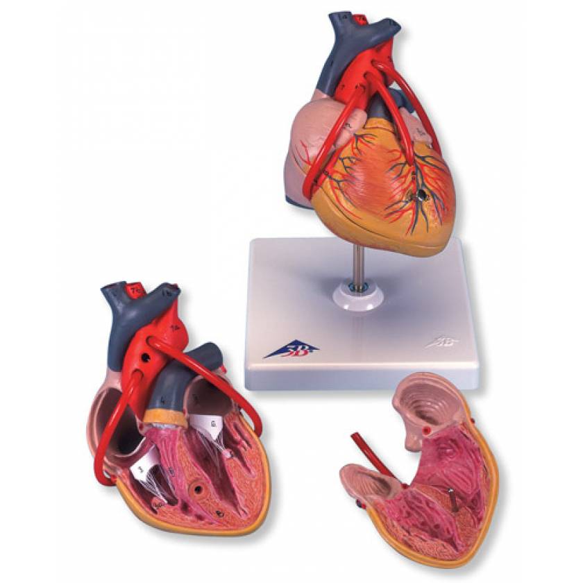 Classic Heart Model with Bypass 2-Part