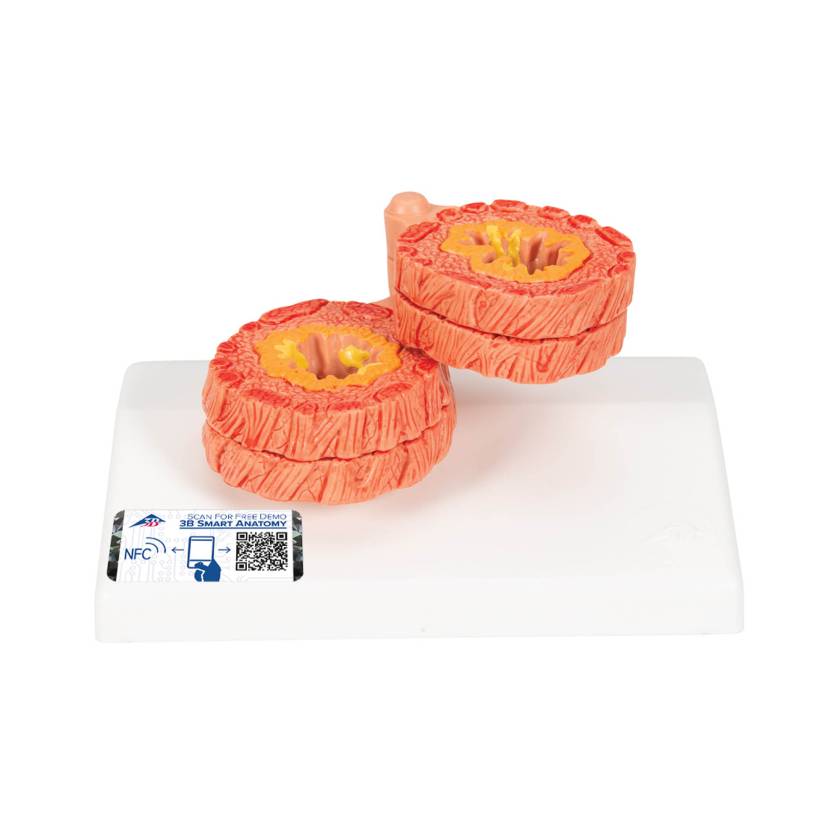 3B Scientific G50/1 COPD Bronchial Tissue Model - 3B Smart Anatomy