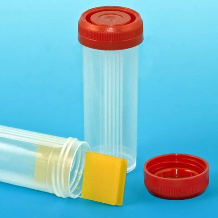 Polypropylene Slide Mailer for 4 Microscope Slides - With Red Screw Cap