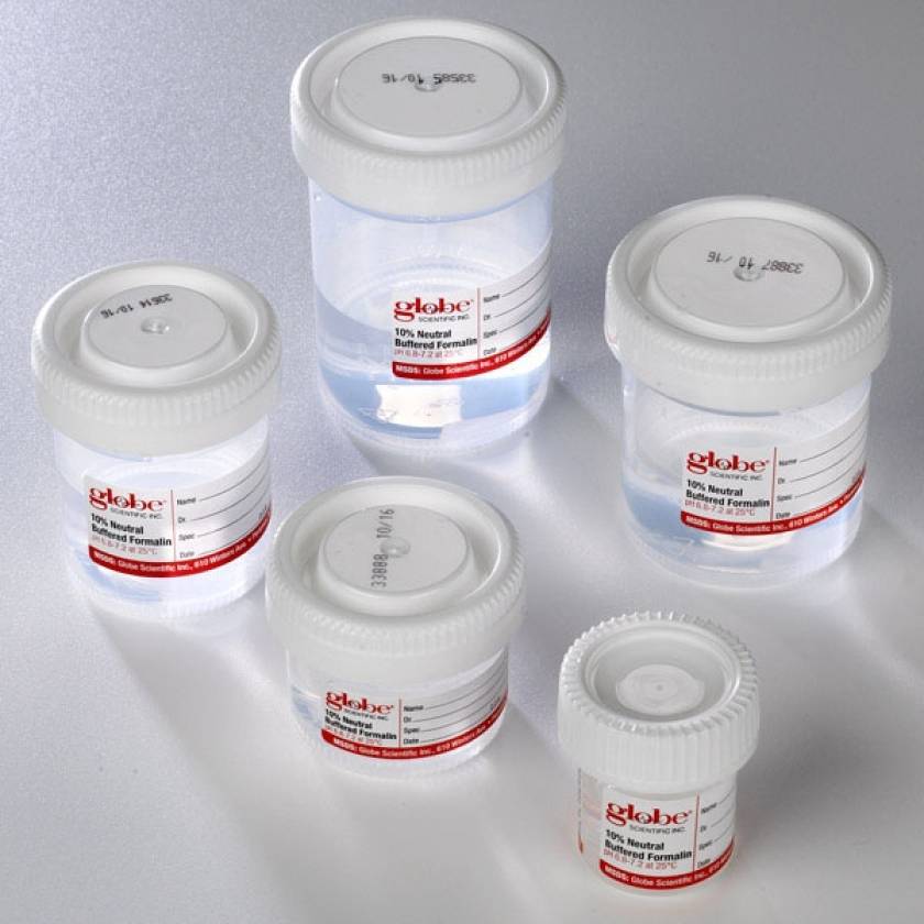 Tite-Rite Containers Pre-Filled with 10% Neutral Buffered Formalin - Attached Hazard Label