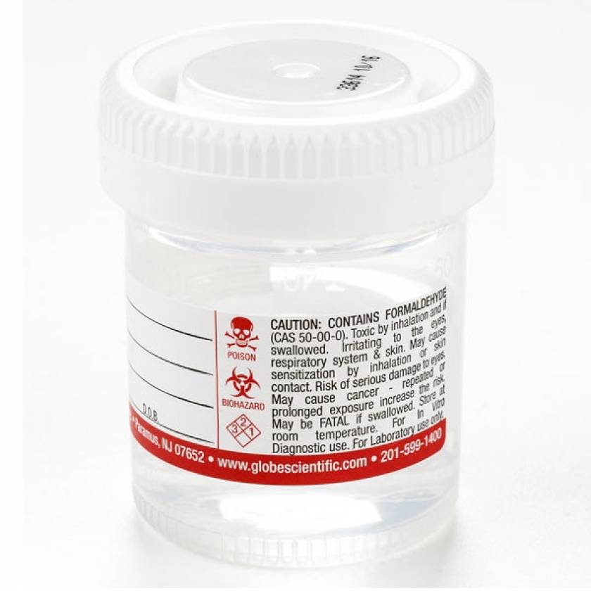 TiteRite Containers Prefilled with 10 Neutral Buffered Formalin Globe