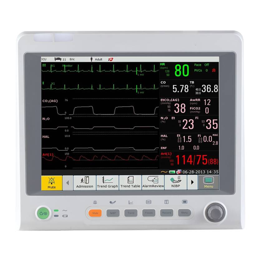 Edan iM70 Patient Monitor with 12.1" Touch Screen and WiFi