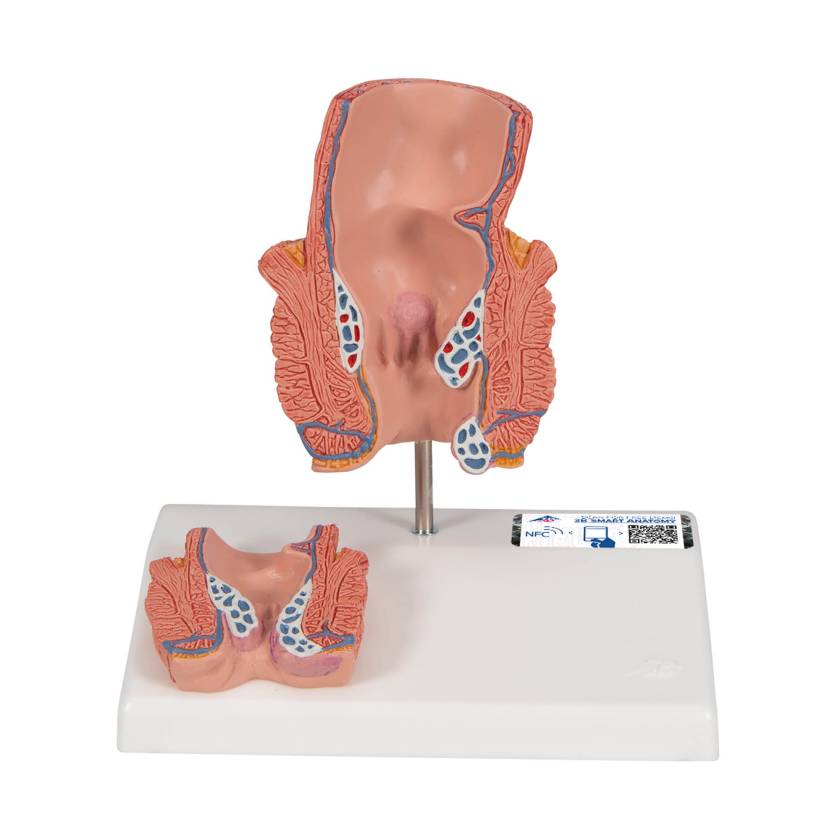 3B Scientific K27 Hemorrhoid Model - 3B Smart Anatomy
