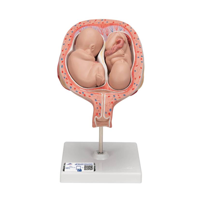 3B Scientific L10/7 Fifth Month Twin Fetus Model - Normal Position