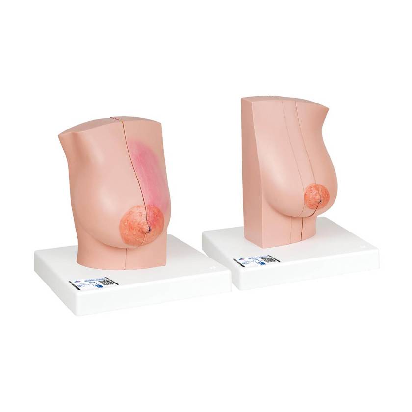 3B Scientific L56 Model of the Female Breast with Healthy and Unhealthy Tissue