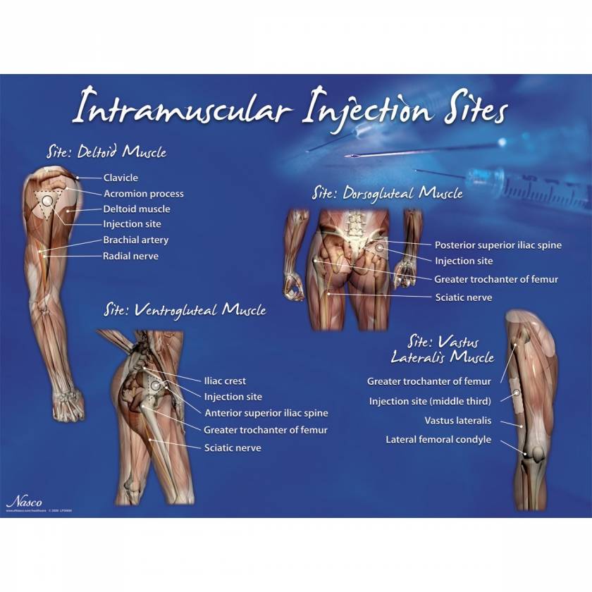 Life/form Intramuscular Injection Sites Poster