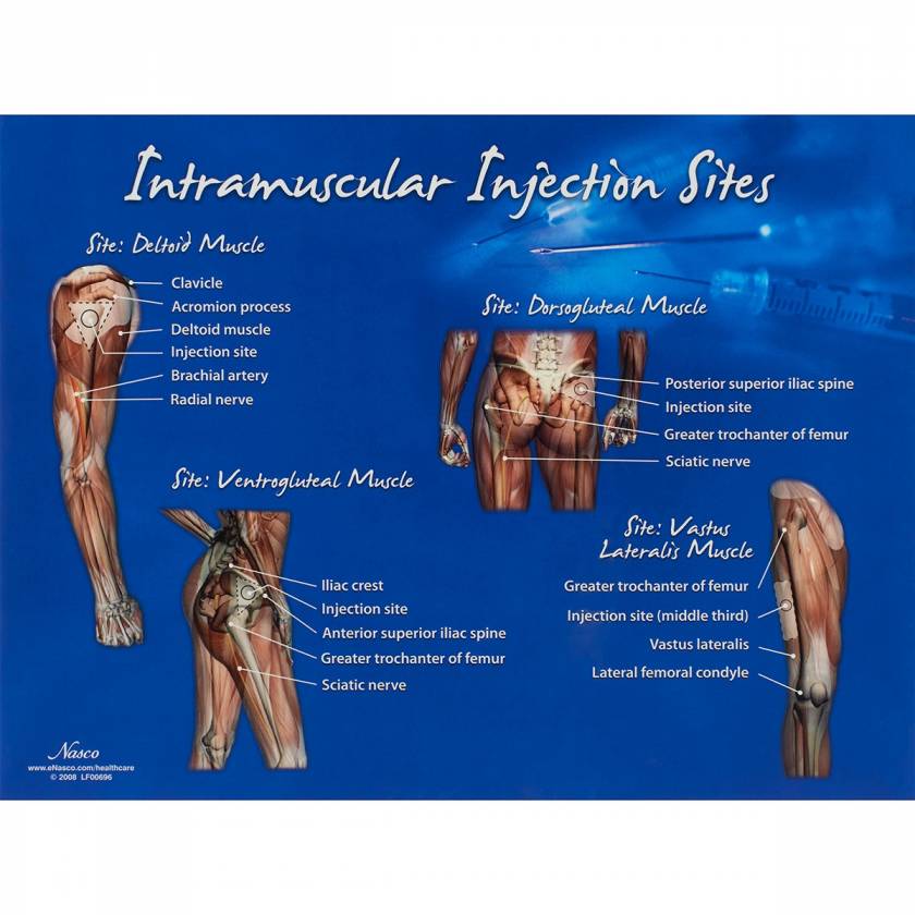 Life/form Intramuscular Injection Sites Chart