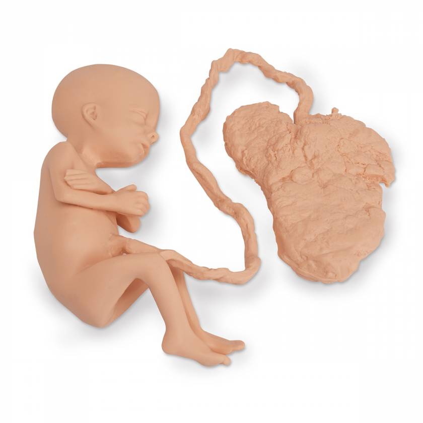 Life/form Human Fetus Replica - 7-Month Female W/ Placenta