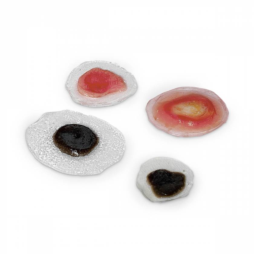 Life/form Moulage Wound - Moles/Skin Cancer Simulator - Set of 4