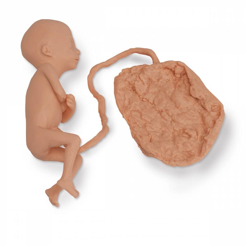 Life/form Human Fetus Replica - 5-Month Female