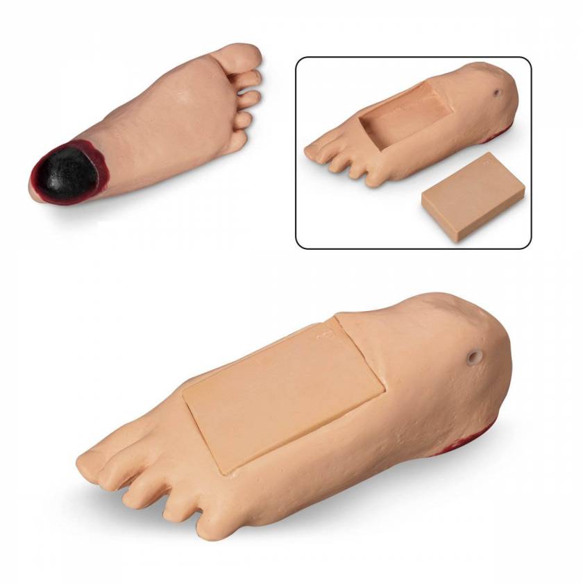 Life/form GERi and KERi Optional Edema Foot with Deep Tissue Injury - Light