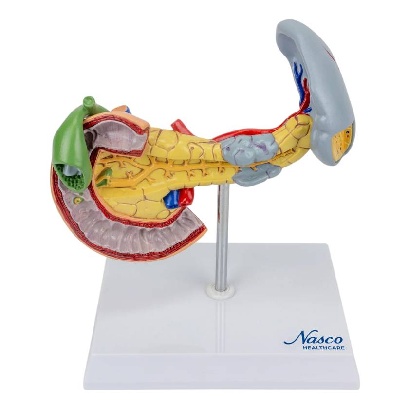 Nasco MG14742 Pancreas, Spleen, and Gallbladder with Pathologies Model - Front View