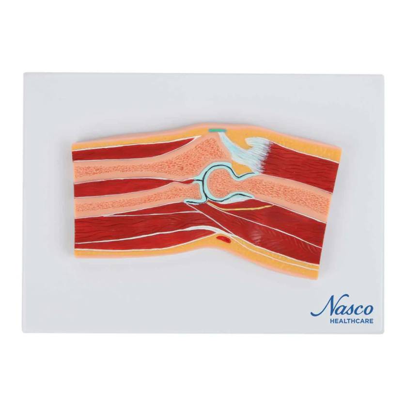 Nasco MG17225 Elbow Model, Median Section - Front View