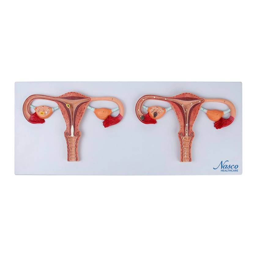Nasco MG19471 Uterus with Fertilization Process Model - Angle 1