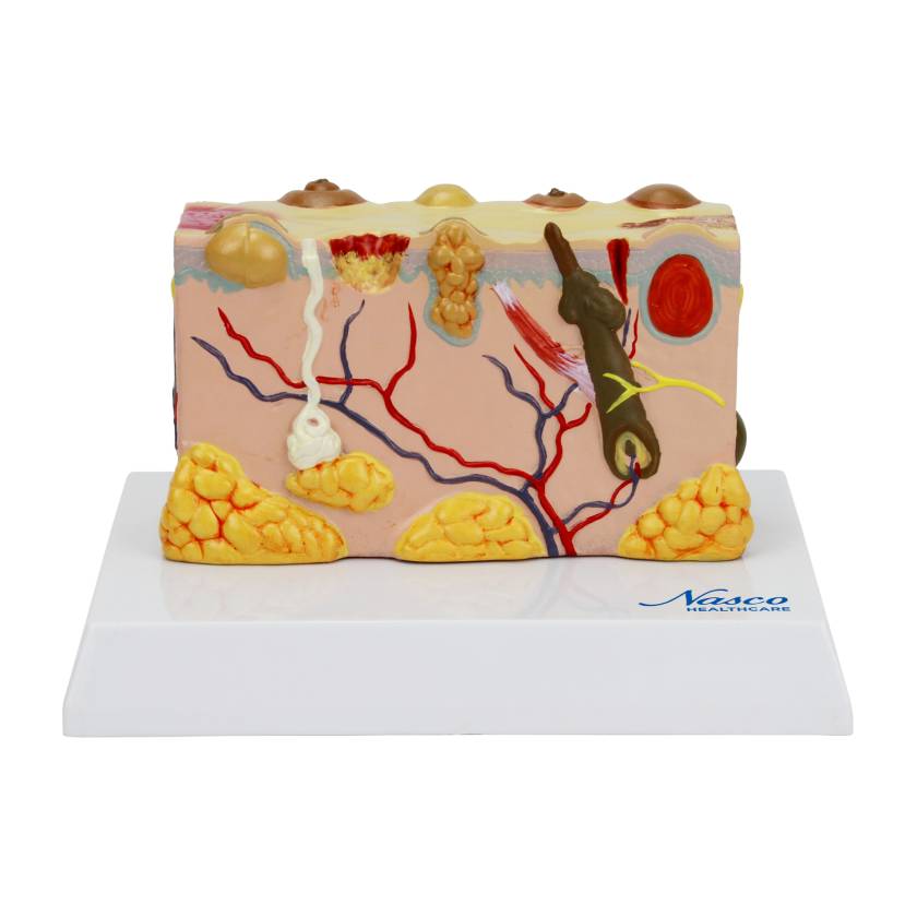 Nasco MG21065 Skin Section with Pathology Model, 30x Enlarged