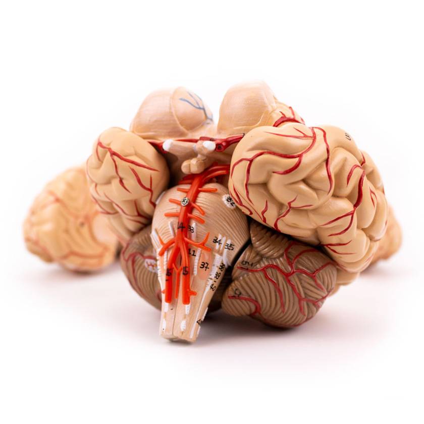 Nasco MG21717 Brain with Arteries Model, 9 Parts - Angle 1