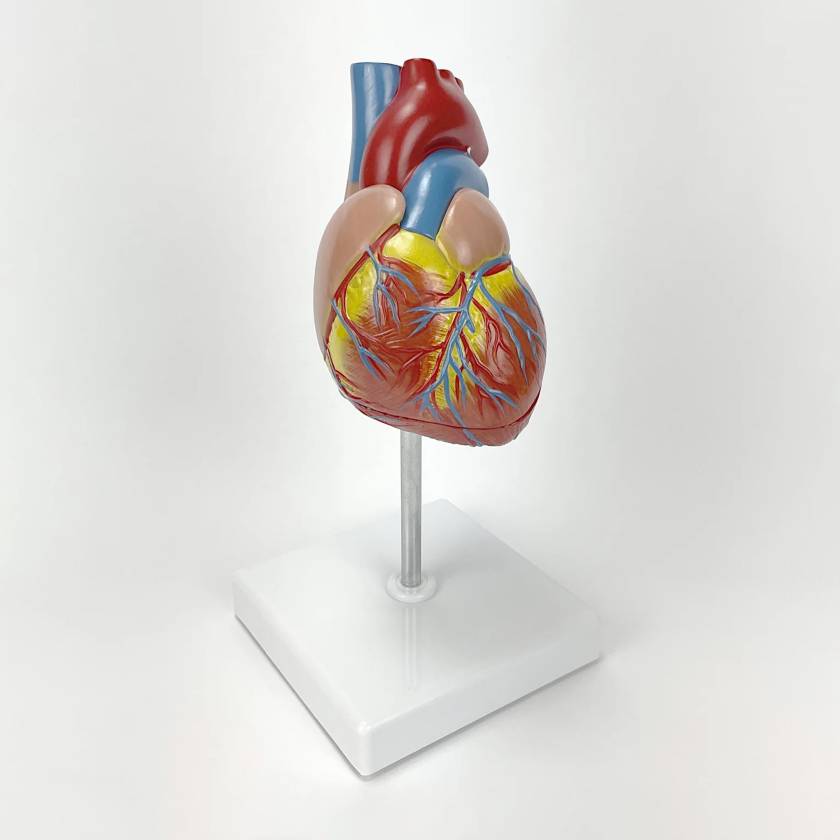 Nasco MG22274 Classic Heart with Ventricular Hypertrophy Model, Right Angle View