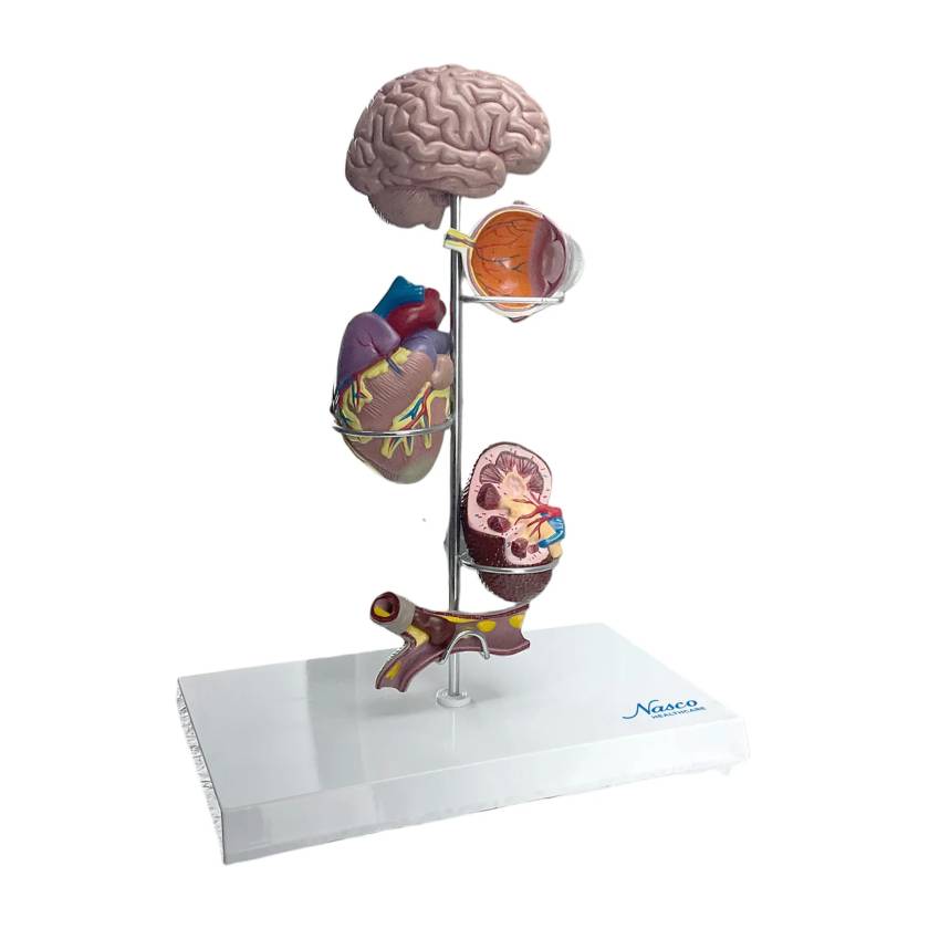 Nasco MG29749 Arterial Hypertension Model