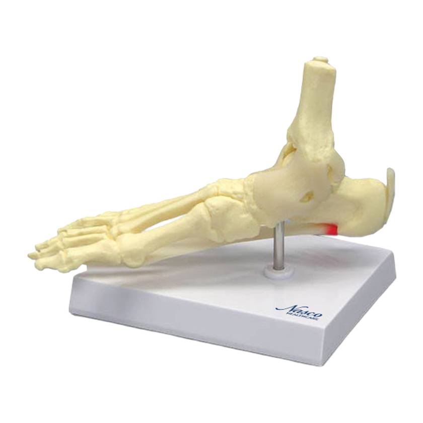Nasco MG29758 Foot and Ankle with Plantar Fasciitis Model, Left Angle View