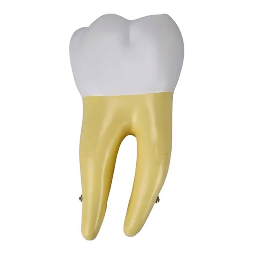 Nasco MG29802 Lower Molar Tooth Model, 2 Parts - Front View