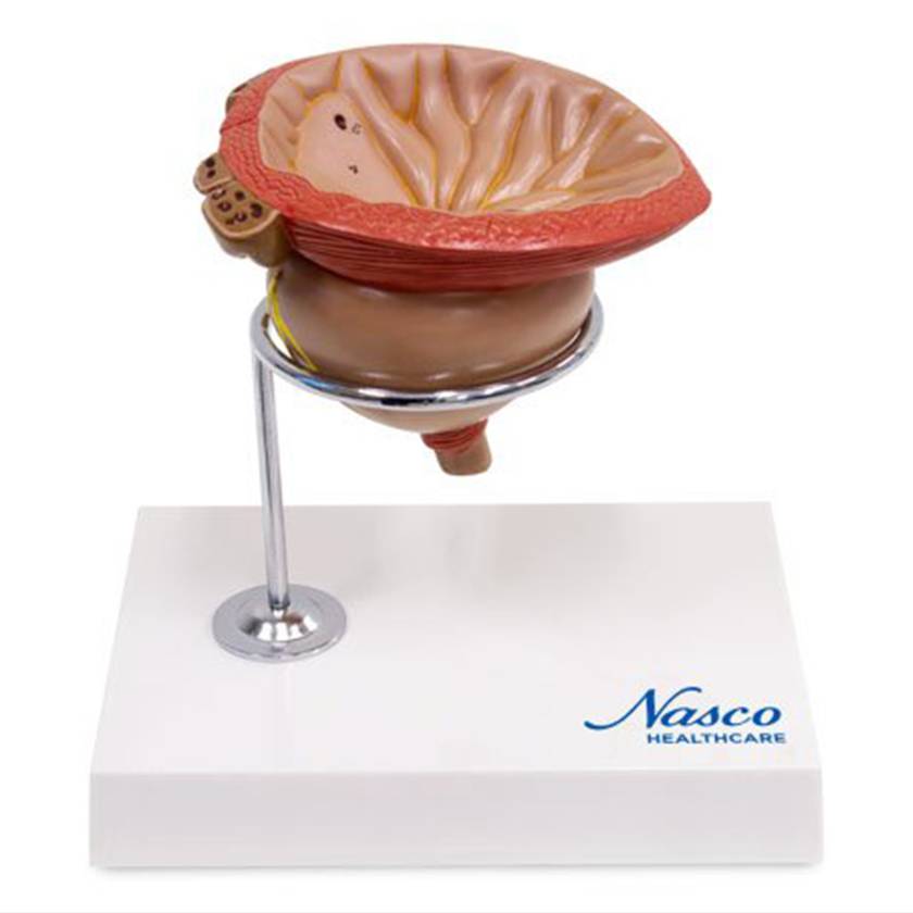 Nasco MG30752 Prostate Model, 2x Enlarged, 4 Parts