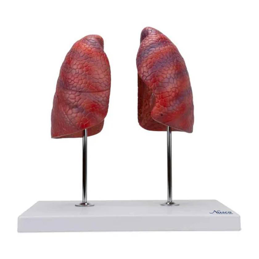 Nasco MG30887 Lung Model, 2-Part, Front View