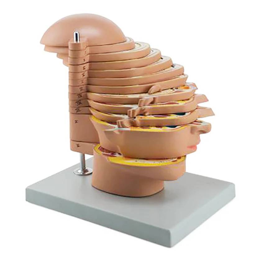 Nasco MG31094 MRI Head Model, 12 Transverse Parts