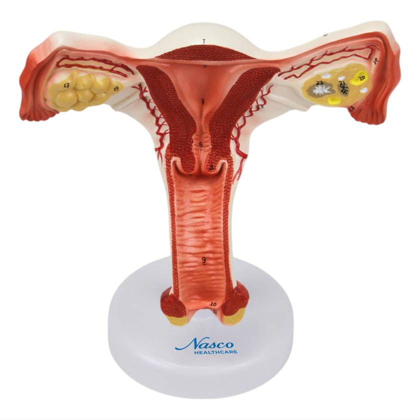 Nasco MG31101 Female Reproductive Organ Section Model, 1.5x Enlarged - Front View