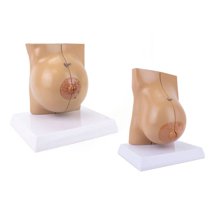 Nasco MG34670 Female Lactating and Non-Lactating Breast Models