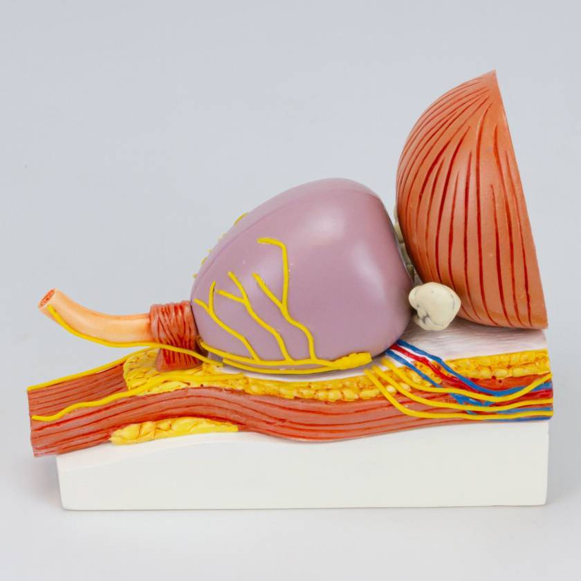 Nasco MG34924 Prostate with Pathology Model - Side View