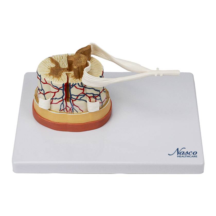 Nasco MG34926 Spinal Cord with Nerve Endings, 6x Enlarged - Angle 1