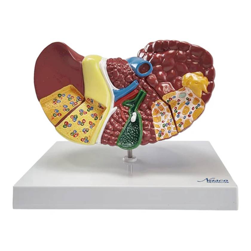 Nasco MG36908 Liver Section with Pathologies Model - Front View