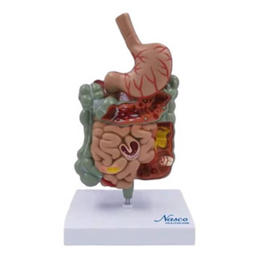 Nasco MG39708 Gastrointestinal Tract with Pathologies Model