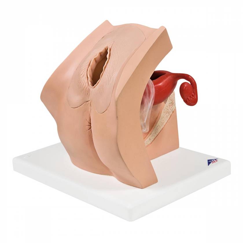 Gynecological Patient Education Model