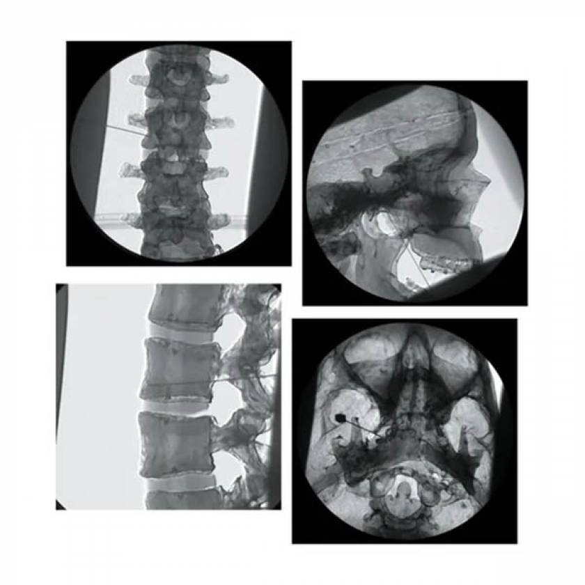Nasco SB38908 Nerve Block/Pain Relief Manikin