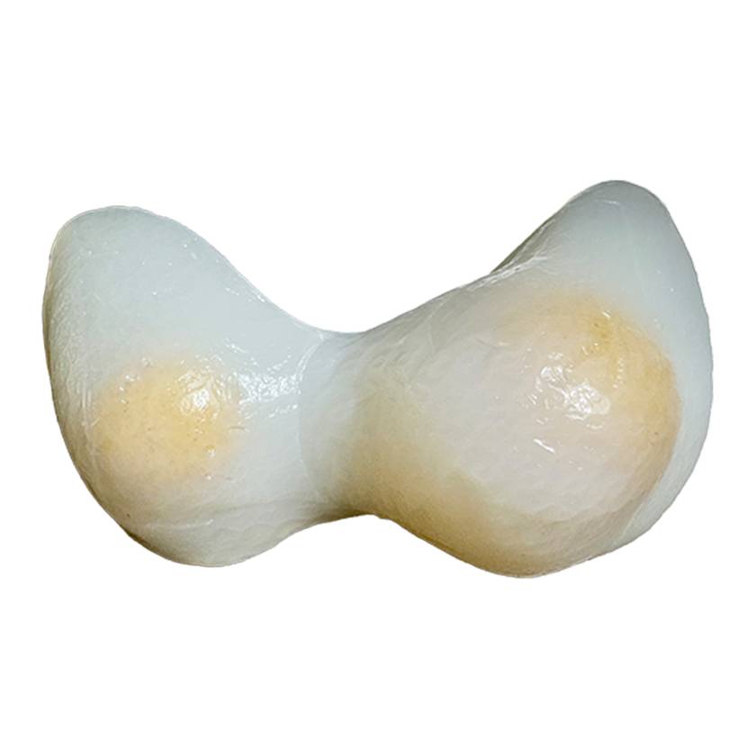 SurgMate THY-S01A Enlarged Thyroid Pad for Thyroid Nodules Biopsy and Ablation Training Platform
