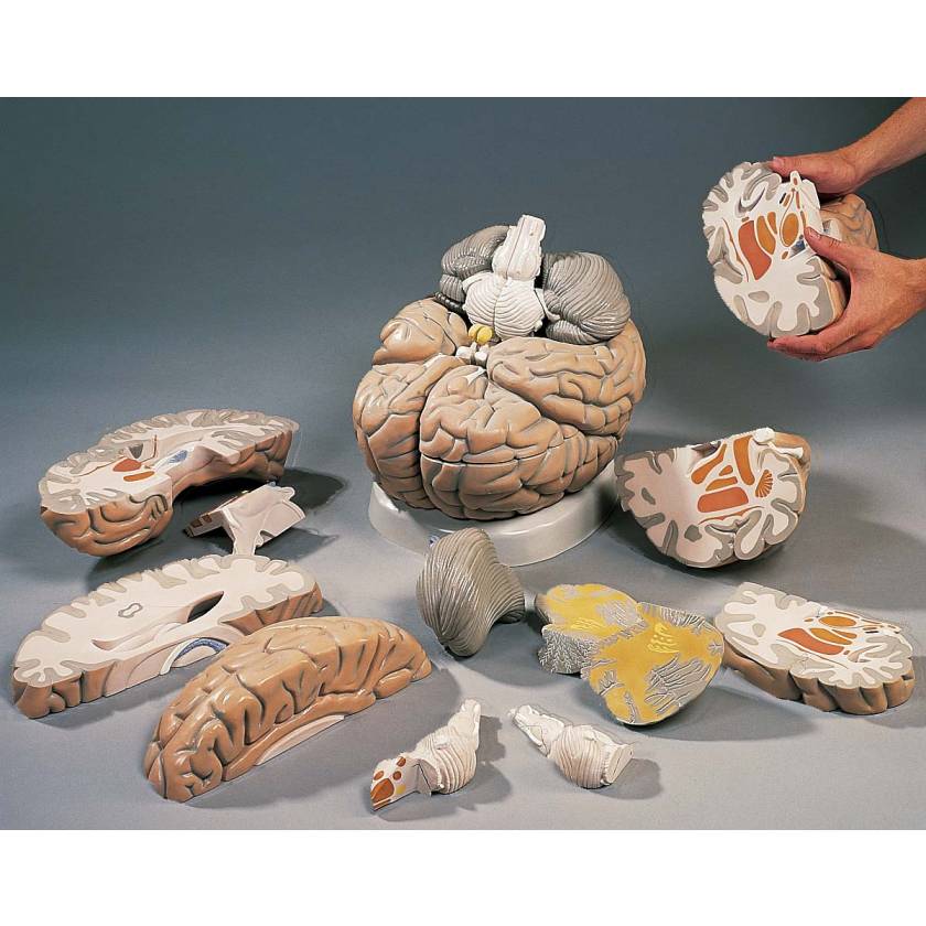 3B Scientific VH409 Giant Brain Model 14Part 2.5x FullSize