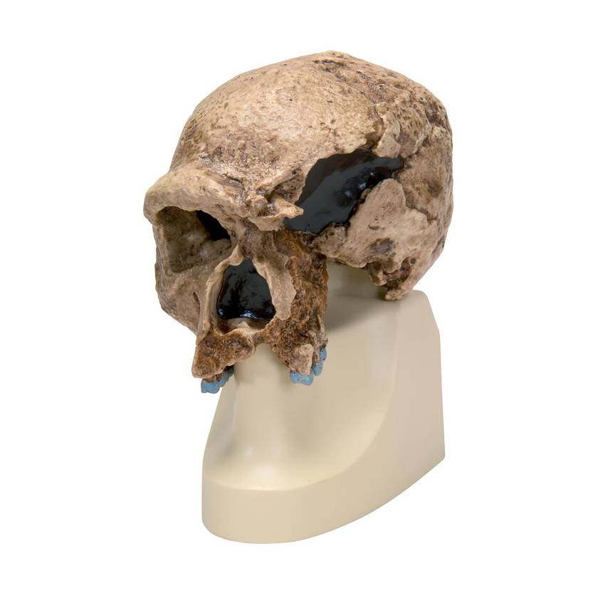 3B Scientific VP753-1 Anthropological Skull Model - Steinheim