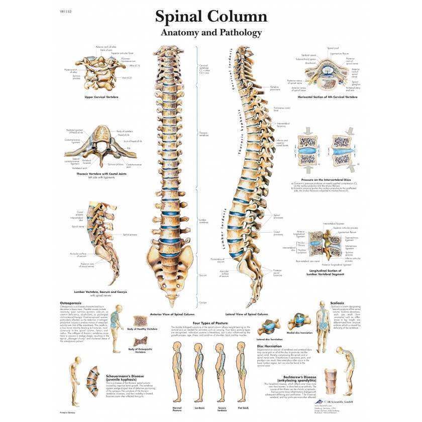 Spinal Column Chart