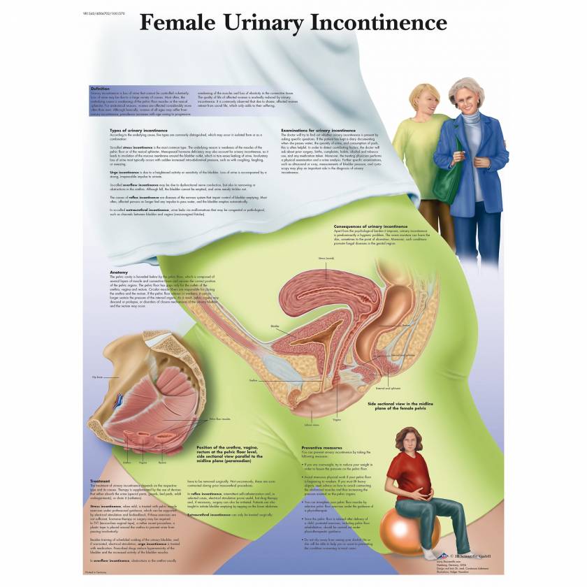 Female Urinary Incontinence Chart