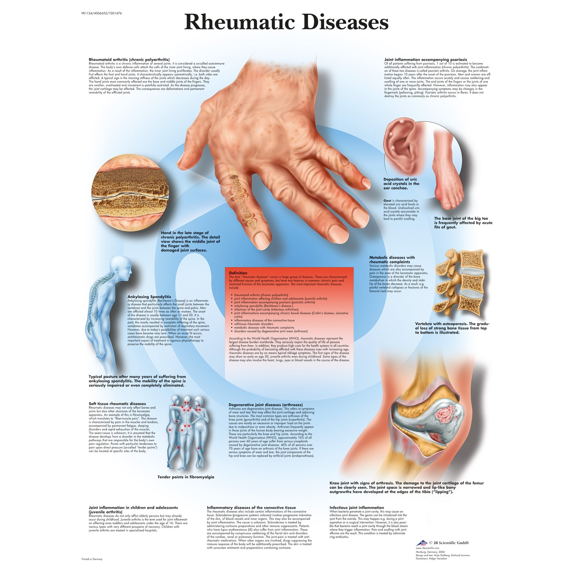 3b Scientific Rheumatic Diseases Chart