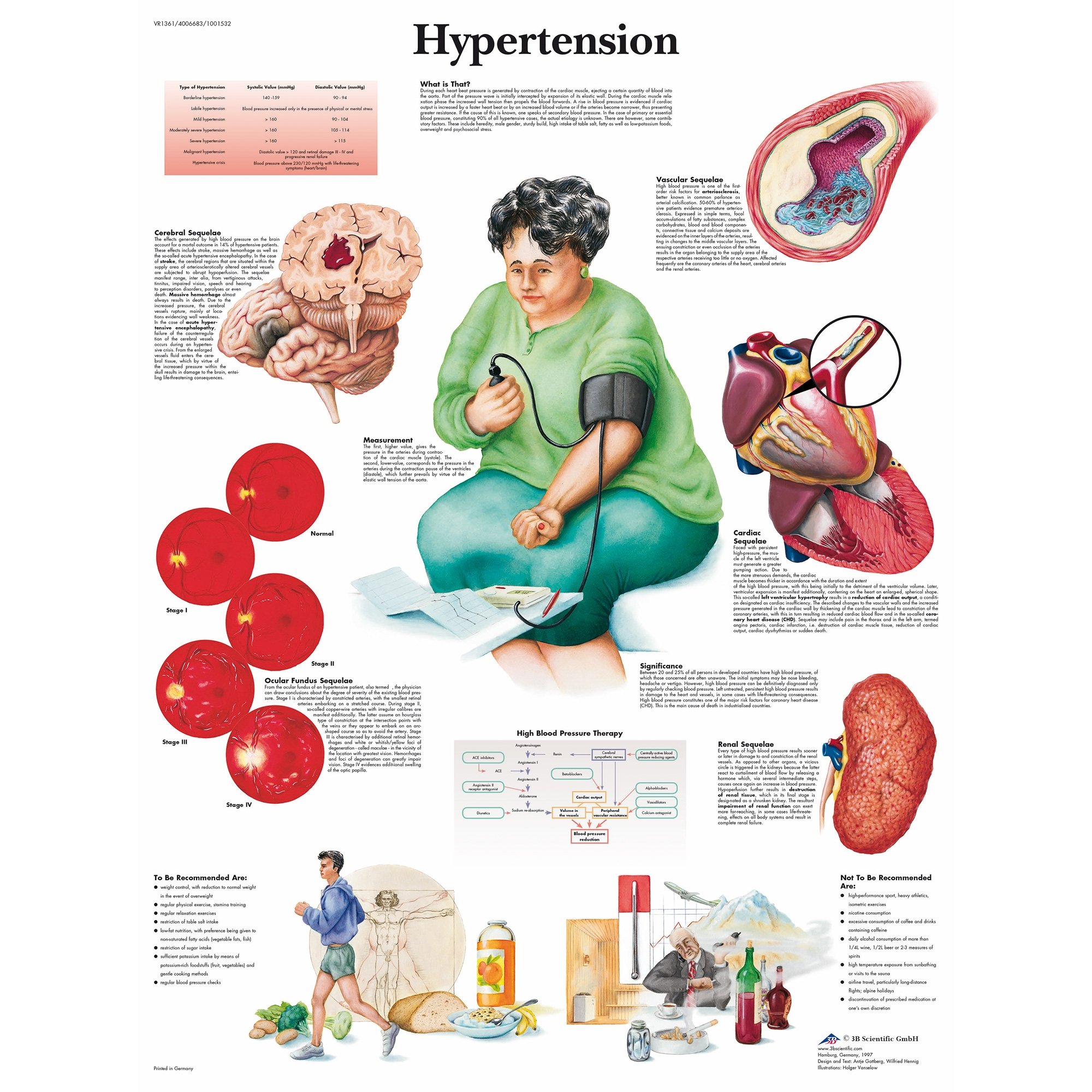 presentation of hypertension