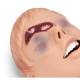 Nasco 101-060 Simulaids Critical Airway Management Trainer