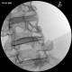 3B Scientific 1021898 Image Guided Lumbar Spinal Injection Trainer, Lumbar Fluoroscopy Block Medial Branch Block (X-Ray Image not included)