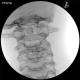 3B Scientific 1021900 Image Guided Cervical Spine Injection Trainer, Cervical Fluoroscopy C1-C2 Anatomy