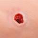 3B Scientific 1022652 Hemorrhage Control Arm Trainer - Light Skin Tone, Small Round Wound